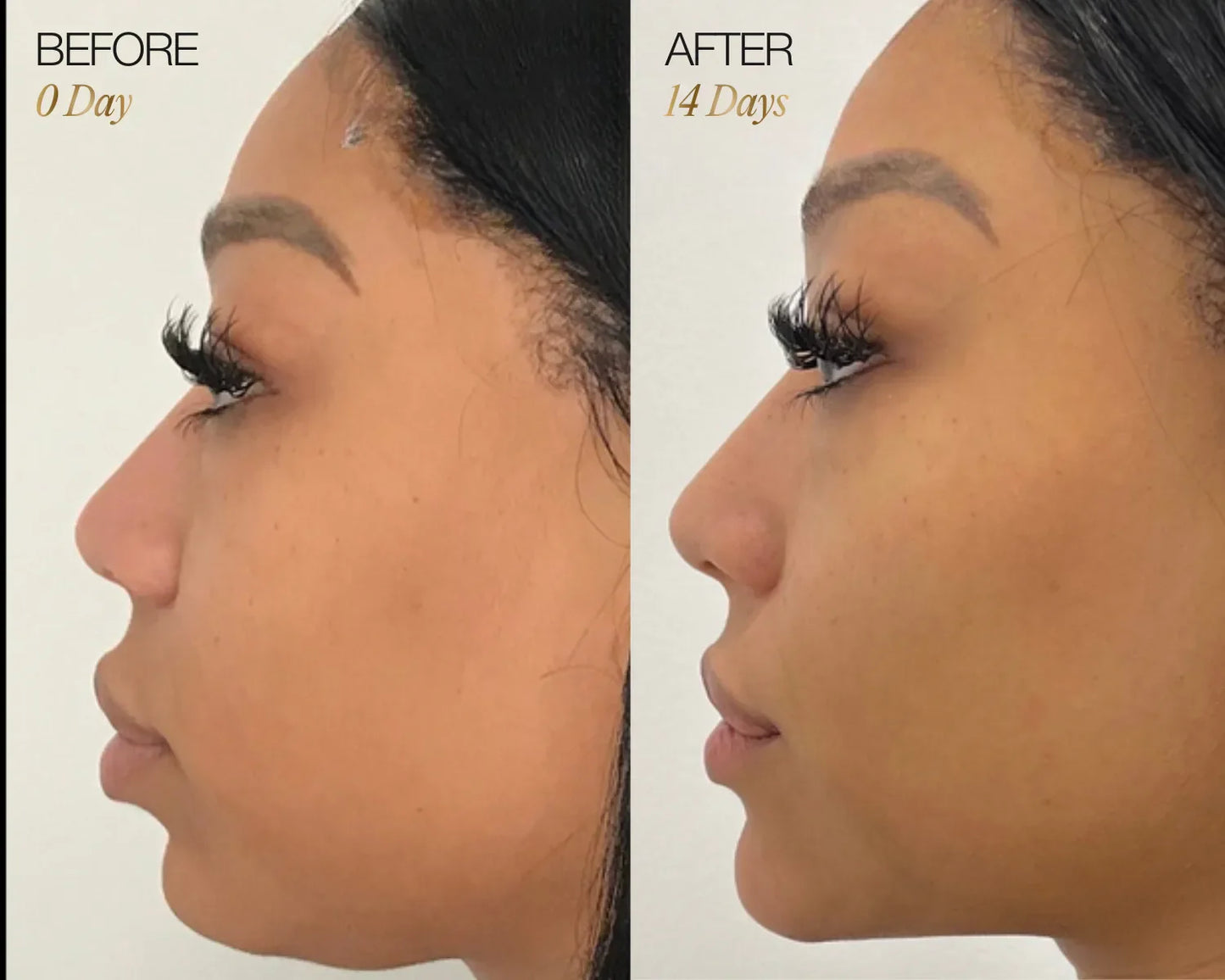 Seravon™ Lymphatic Face Brush